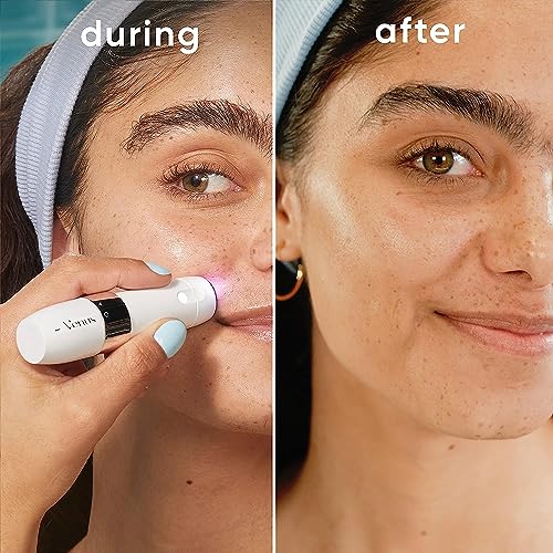 Portable Electric Facial Hair Remover N9551