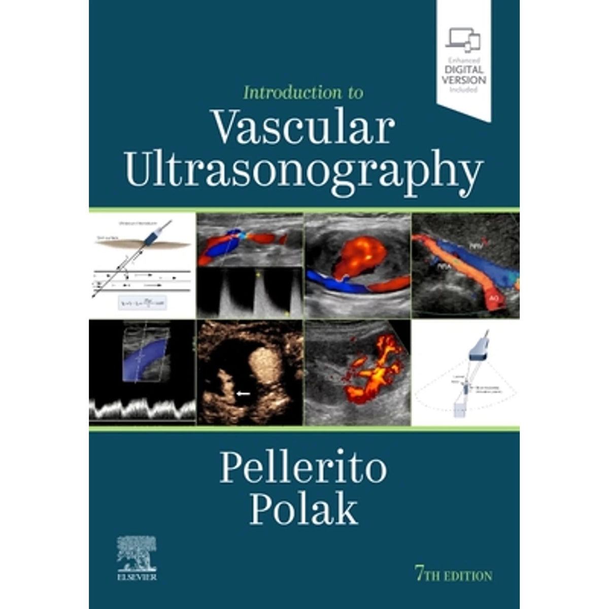 Introduction to Vascular Ultrasonography Hardcover M949231